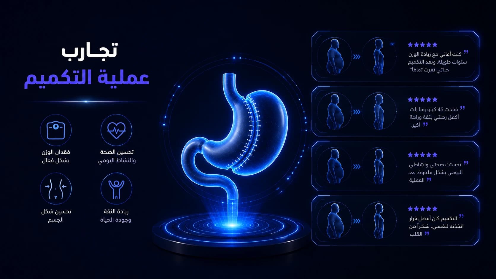 Sleeve Gastrectomy Experiences