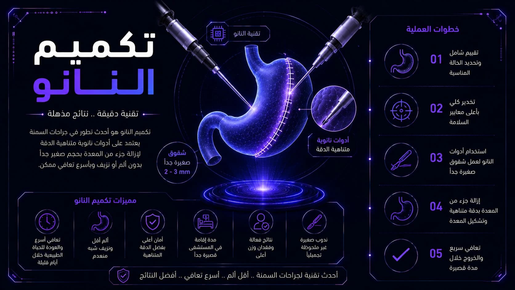 Nano sleeve gastrectomy